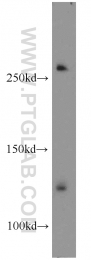 17137-1-AP - RBM12B