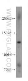 17137-1-AP - RBM12B