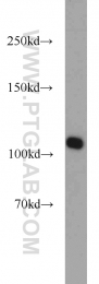 10587-1-AP - RBM15