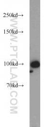 10587-1-AP - RBM15