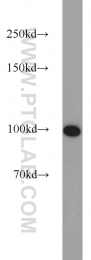 10587-1-AP - RBM15