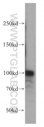 10587-1-AP - RBM15