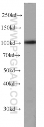 66059-1-Ig - RBM15