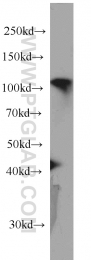66059-1-Ig - RBM15