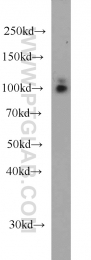 66059-1-Ig - RBM15