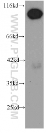 66059-1-Ig - RBM15