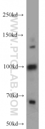 22249-1-AP - RBM15B