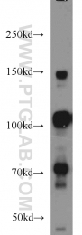 22249-1-AP - RBM15B