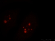 19095-1-AP - RBM19
