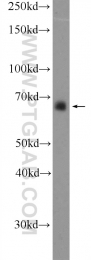 21339-1-AP - RBM39