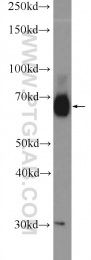 21339-1-AP - RBM39