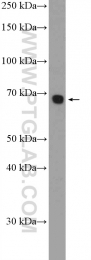 21339-1-AP - RBM39