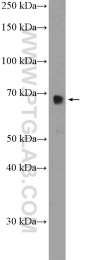 21339-1-AP - RBM39