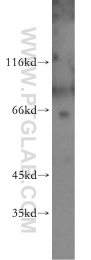 21339-1-AP - RBM39