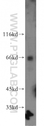 21339-1-AP - RBM39