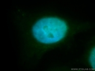 11614-1-AP - RBM4 / RBM4A