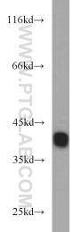 11614-1-AP - RBM4 / RBM4A
