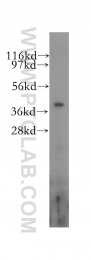 11614-1-AP - RBM4 / RBM4A
