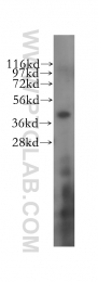 11614-1-AP - RBM4 / RBM4A