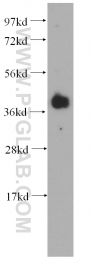 11614-1-AP - RBM4 / RBM4A