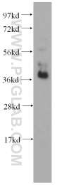 11614-1-AP - RBM4 / RBM4A