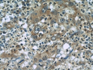 60292-1-Ig - RBM4 / RBM4A