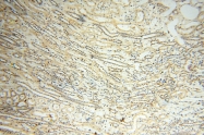 14958-1-AP - RBM8A / RBM8