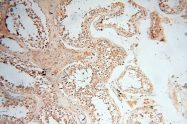 14958-1-AP - RBM8A / RBM8
