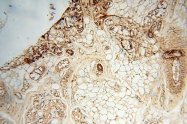 14958-1-AP - RBM8A / RBM8