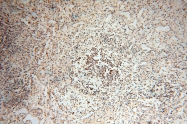 14958-1-AP - RBM8A / RBM8