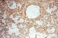 14958-1-AP - RBM8A / RBM8