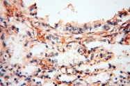 14958-1-AP - RBM8A / RBM8