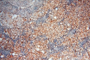 14958-1-AP - RBM8A / RBM8