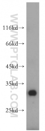 17994-1-AP - RBMX2