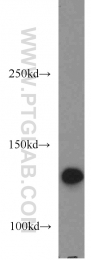 14352-1-AP - Retinol-binding protein 3 / RBP3