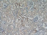 14541-1-AP - Retinoid-binding protein 7 / RBP7