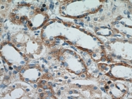 14541-1-AP - Retinoid-binding protein 7 / RBP7