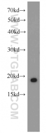 14541-1-AP - Retinoid-binding protein 7 / RBP7