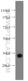 14541-1-AP - Retinoid-binding protein 7 / RBP7