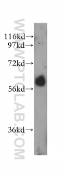 14613-1-AP - RBP-J kappa / RBPJ
