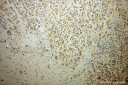13790-1-AP - Radixin / RDX