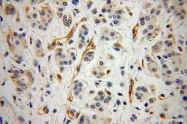 13790-1-AP - Radixin / RDX