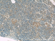 13790-1-AP - Radixin / RDX