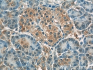 13790-1-AP - Radixin / RDX