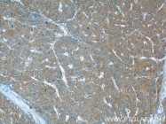 13790-1-AP - Radixin / RDX