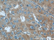 13790-1-AP - Radixin / RDX
