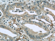 13790-1-AP - Radixin / RDX
