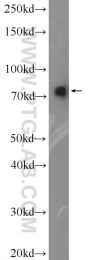 13790-1-AP - Radixin / RDX