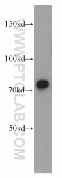 13790-1-AP - Radixin / RDX
