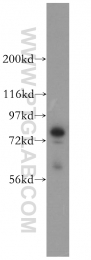 13790-1-AP - Radixin / RDX